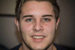 Arron Hartley